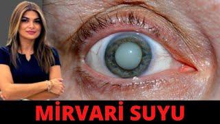 Mirvari Suyunun Əmələ Gəlmə Səbəbi nedir? - KATARAKTA