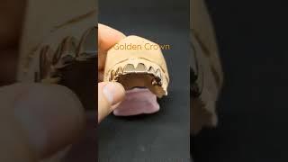Wow Amazing Golden Crowning|How Golden Crowning are Made|Tooth Golden Crowning|Modren Dentistry.