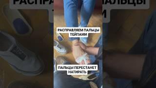 Возвращаем пальцам жизнь с помощью тейпов и стелек#тейпирование #тейп #тейпированиеног #натоптыши