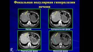 Лекция: «Многофазная компьютерная томография в оценке гепатобилиарной системы»