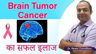 Brain Tumor Cancer Best Treatment | दिमाग में गाँठ | Best Doctor for Brain Tumor