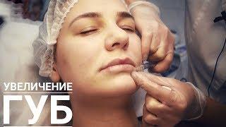 Увеличение губ в салоне красоты ЛИЛУ