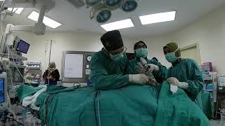 Functional Endoscopic Sinus Surgery (FESS), A rhino surgeon's day in a work