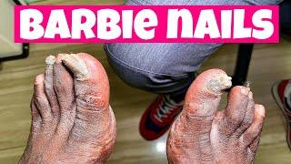 HOW TO TRIM BARBIE TOENAILS!!