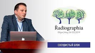 Ваге Бакунц. Роль МРТ при диагностике сердечно-сосудистой патологии