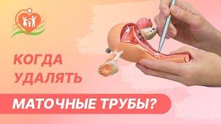 ‍️  Когда удалять маточные трубы?