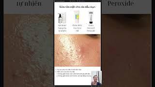 Cách chọn sữa rửa mặt cho da dầu mụn chuẩn y khoa