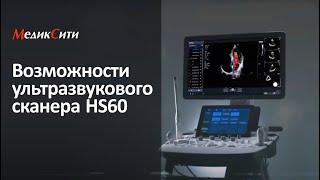 Ультразвуковой сканер HS60 (Samsung Medison). Клиника "МедикСити"