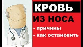 Почему идет кровь из носа: причины, способы остановки