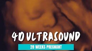 Amazing 4D Ultrasound at 28 weeks pregnant