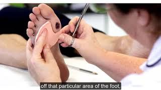 Deflective pressure relief pad for blisters