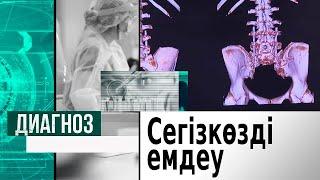 Сегізкөзді емдеудің ерекше әдістері туралы | Диагноз