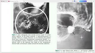 GIT IMAGING THE TEACHING FILES SERIES