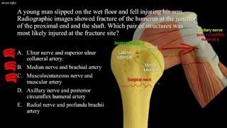 Fractures of the humeurs and possible nerve injuries