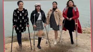 Beautiful amputee girls and the challenge of disability #amputee