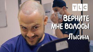 Лысина | Верните мне волосы | TLC