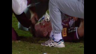 Ian Roberts Breaks Jason Smith's Jaw - Origin 1994