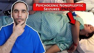 What are Psychogenic Nonepileptic Seizures (PNES)