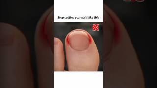 correct way of cutting nails|#nails #makeup #baby #manicure #pedicure #howto #style #shorts #viral