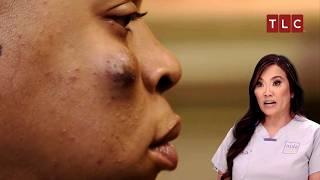 The Cyst That Keeps Staring Back! | Dr Pimple Popper TLC