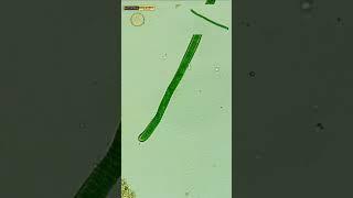 CyanoBacteria (Discover)