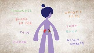 What is Kidney Cancer? | National Kidney Foundation