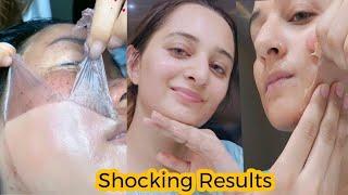 I Tried Chinese Skin Whitening Peel Off Mask Removed All Pigmentation Scars Dirt Get Bright Face