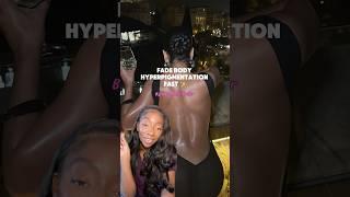How to Fade Body Hyperpigmentation FAST! 