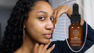 Pure Botanicals Snow Mushroom Serum | Dry Skin Winter 2021 |  Skin Update | LoveMsLiz