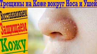 Трещины и сухость кожи в районе носа и за ушами!