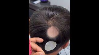 Look this amazing custom toupee!!!/men hair systems