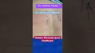 Suffering from pain#hemantmemorialspinehealthcare # dr.manojpoonia #physiotherapy #dryneedling