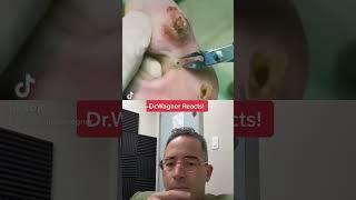 WHAT’S UNDERNEATH?  #shorts #abscess #jawspodiatry