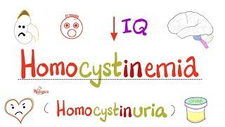 Homocystinemia (Homocystinuria) - Causes, Symptoms, Diagnosis, Treatment - Biochemistry & Genetics