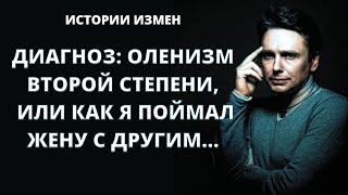 ДИАГНОЗ: ОЛЕНИЗМ ВТОРОЙ СТЕПЕНИ, ИЛИ КАК Я ПОЙМАЛ ЖЕНУ С ДРУГИМ | ИСТОРИИ ИЗМЕН | АУДИОРАССКАЗ