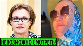 УЖАС! ПЕРЕБОРЩИЛА С ПЛАСТИКОЙ! Что случилось с актрисой Ириной Розановой?