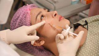 Dermal Filler Injection Techniques