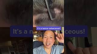 What is This Odd Growth on His Scalp? #shorts #scalp