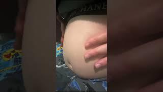 Burps after eating