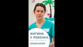  Ангина у детей: симптомы и лечение. Как лечить ангину у ребенка. 12+