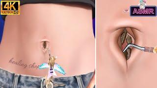 [ASMR] Cool and clean! Belly stone removal, belly button removal animation asmr/4k/