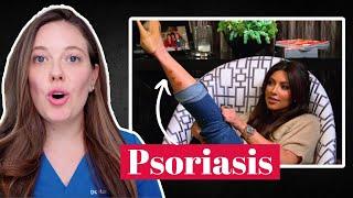 Kim Kardashian’s Shocking Skin Rash | Dr. Hannah Kopelman Reacts