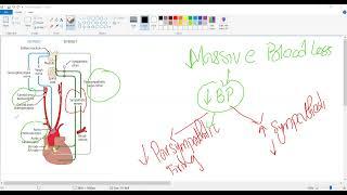 Baroreceptor reflex|Postural hypotension|cardiology USMLE STEP 1