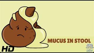 Mucus In Stool: Everything You Need To Know