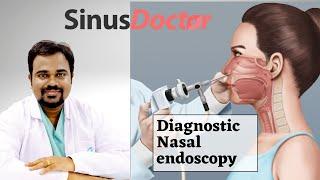 DNE | Diagnostic nasal endoscopy | Endoscopy for sinusitis