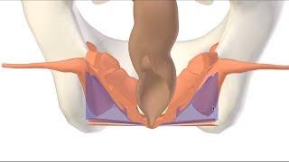 3D Ischioanal (Ischiorectal) Fossa