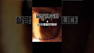 '이 증상' 나타나면 실명 될 수 있습니다! 혹시 이 증상도..?! #실명 #실명증상 #실명질환