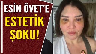 GAZETECİ ESİN ÖVET'E 'ESTETİK' ŞOKU!