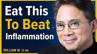 The 5 Amazing Foods That Can Help Arthritis (Reduce Inflammation) | Dr. William Li