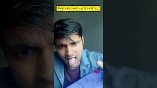 Tiktok teeth magic #shorts #explore #trending #memes #meme #amazing #deomitroy #funny #comedy